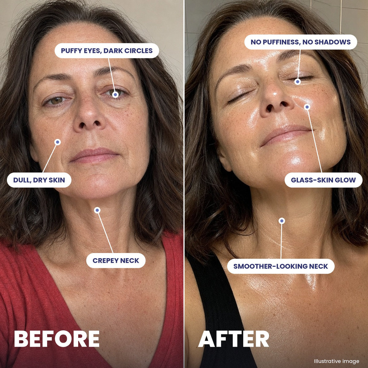 Before and after a castor oil routine: puffy eyes and dark circles (illustrative image)